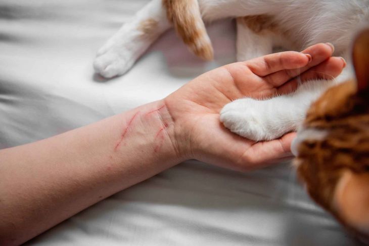 what happens if dog nail scratches you