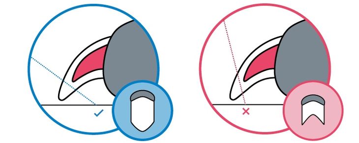 where to clip dog nails